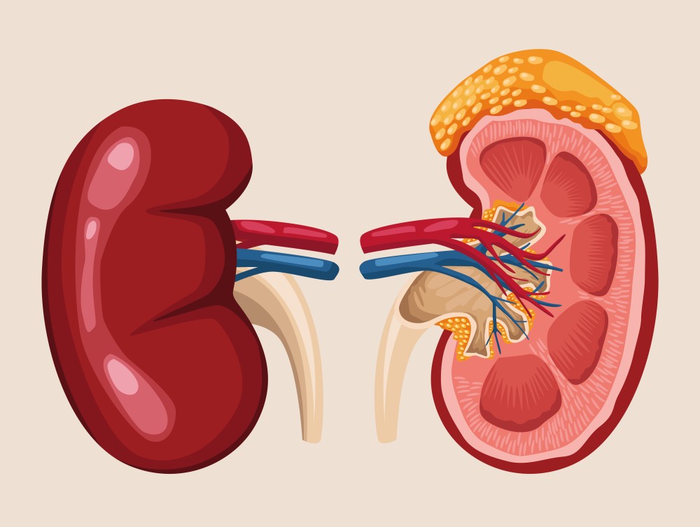 Kidney Transplant